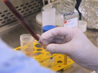 Inspirierende Frauen in der translationalen Medizin